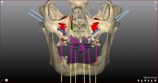 Juan Carlos Romero Alvarado-6