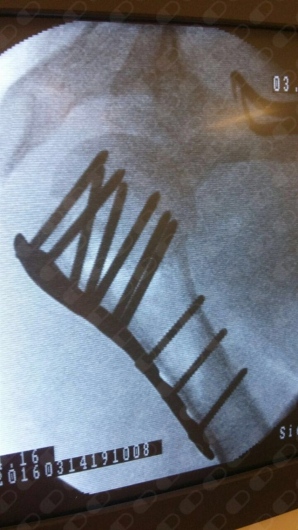 Neftali Lagos Mariscal-6