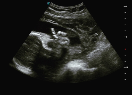 Karla Maria Contreras Legorreta-0