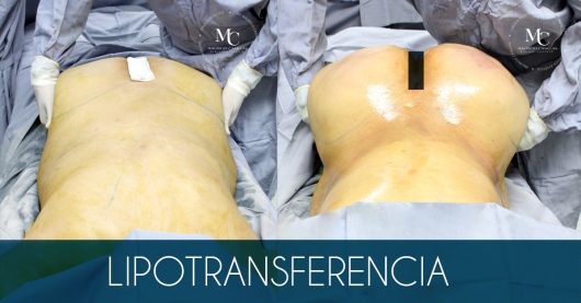 Carlos Mauricio Casillas Ibarra-7