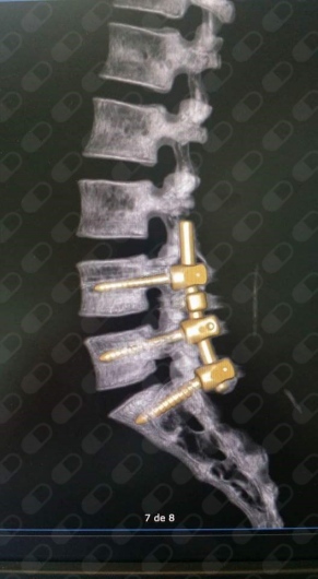 Alejandro Martínez Ramírez-32