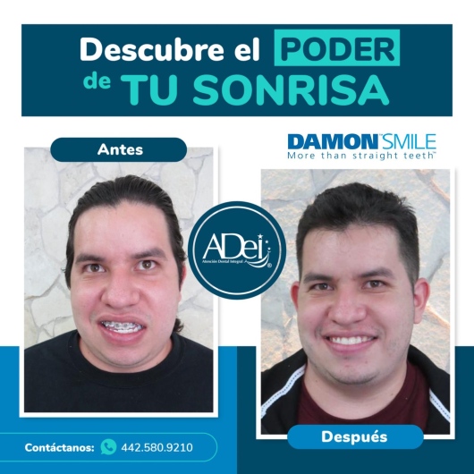 Víctor Amador-4