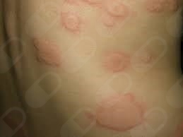 Miguel Angel Melgarejo Ramos-6