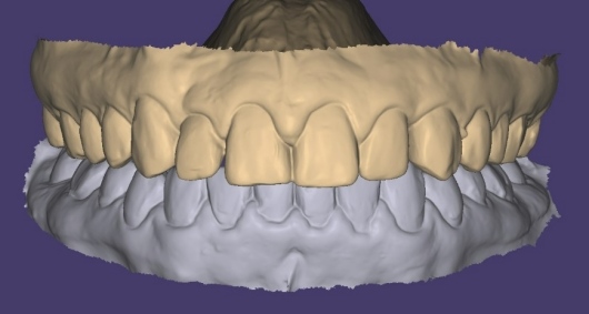 Dilan González Castrejon-6