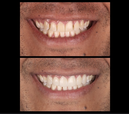 Dilan González Castrejon-1