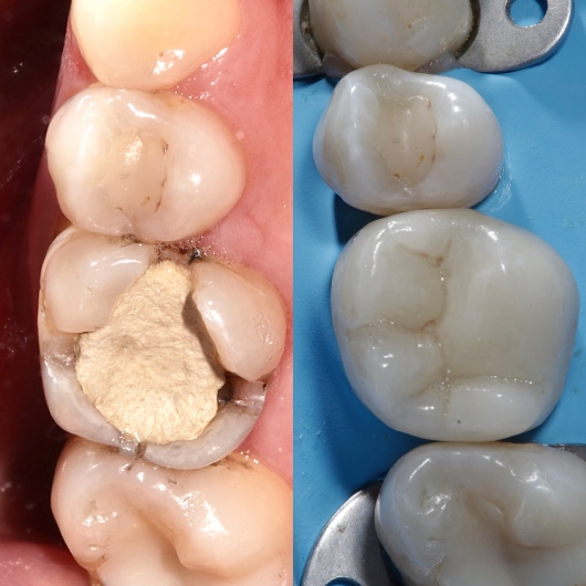 Hugo Moran Negrete-6