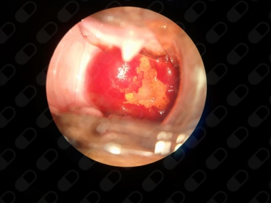 Sandra Cruz Rayón-3