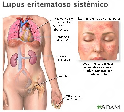 Esteban Meza Zempoaltecatl-6
