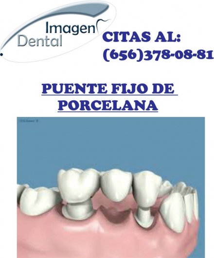 Leonel Palma Carlos-22