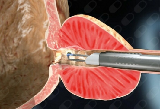 Abner Gonzalez Cortes-2