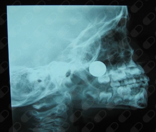 Rosalba Elizabeth Copado Ceballos-12