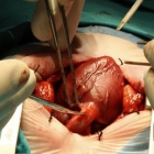 Dra. Mitzi Santos Monter