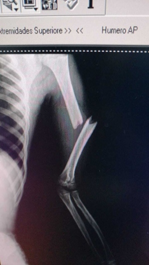 Valerio Licerio De La Cruz-22