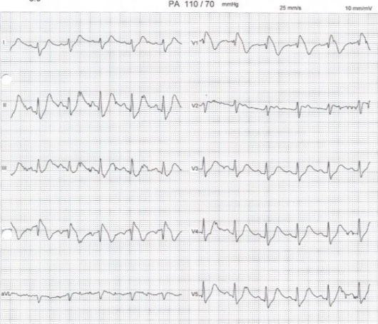 Alex Daniel Pacheco Bouthillier-3