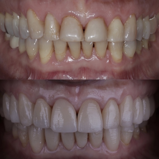 Hugo Moran Negrete-11