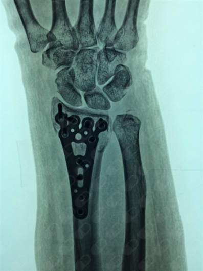 Miguel Hernández Contreras-3