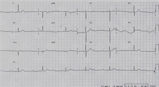 Alex Daniel Pacheco Bouthillier-8