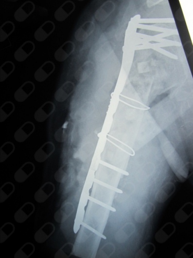 Luis Enrique Pérez Chávez-7