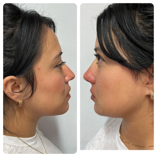 Arturo Romero Grande-8