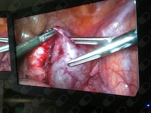 Wilberth Méndez Vivas-6