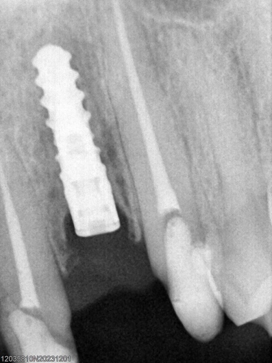 Glenn Aguayo Reyes-0