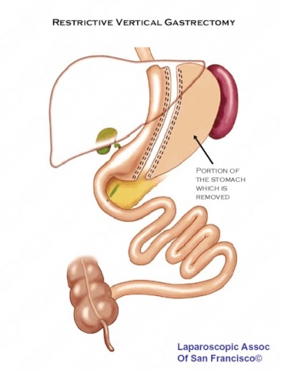Jose Antonio Diaz Villalobos-3