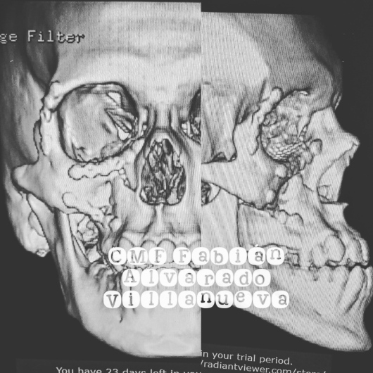 Fabián Alvarado Villanueva-1