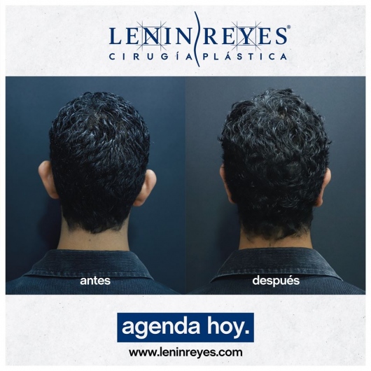 Lenin Alfonso Reyes Ibarra-44