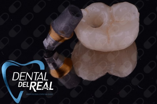 José Francisco Del Real García-92