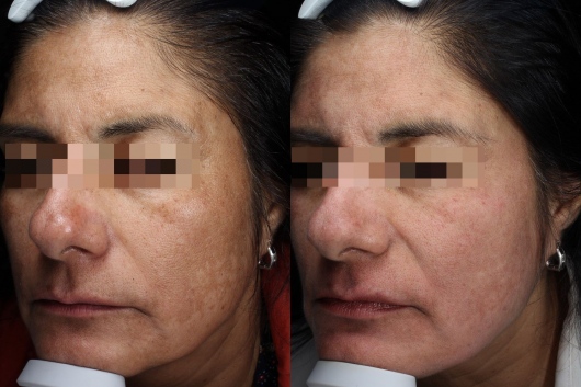 Dafne Arellano Montalvo-22