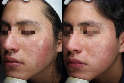 Dafne Arellano Montalvo-25