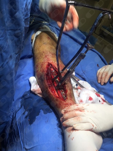 Óscar García Prieto-8