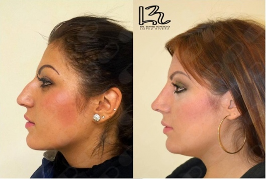 David Ignacio López Rivera-6