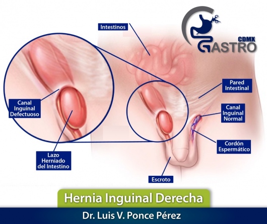 Luis V Ponce Pérez-1