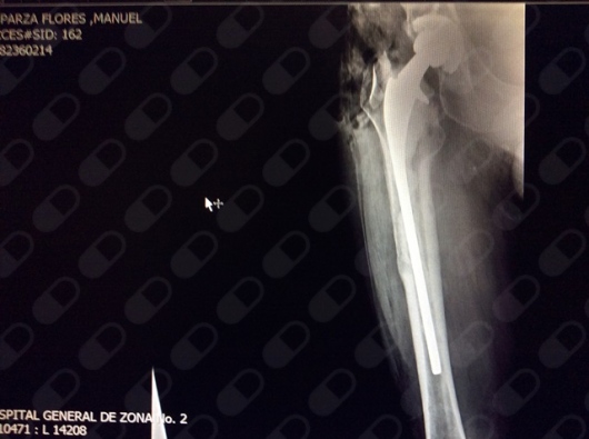 Agustín Rosendo Molina Morquecho-0