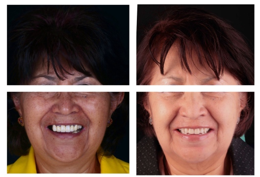 Dilan González Castrejon-17