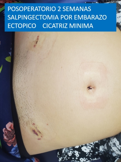 Carlos Alberto Servin Hernandez-0