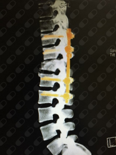 Edgar Abel Márquez García-6