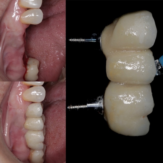 Hugo Moran Negrete-13