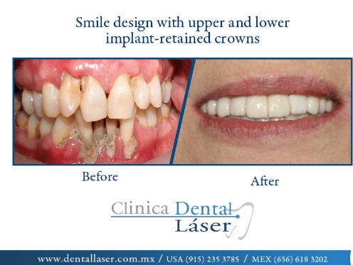 Zonia Edith Barrandey Orozco-3