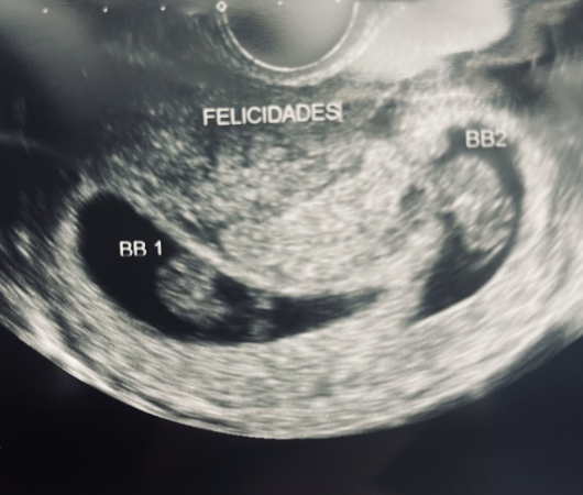 María Guadalupe Nolazco Beltrán-15