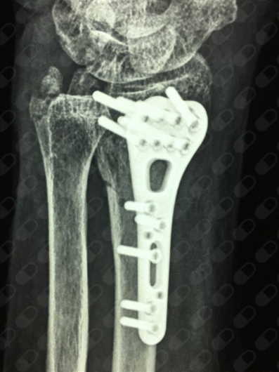 Oscar Fernando Orozco Romo-7