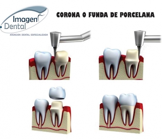 Leonel Palma Carlos-15