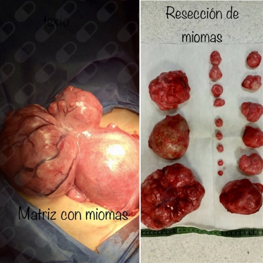 Olga Alejandra Muñoz Chablé-15