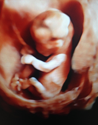 Mario Isaac Lumbreras Márquez-3