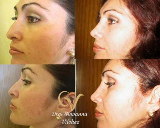 Giovanna Vilchez García-10