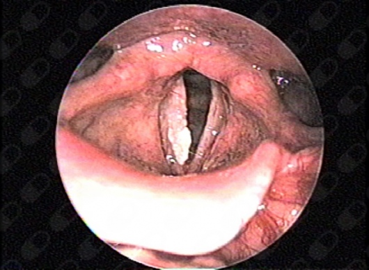 Amparo Sumano Gotoo-6