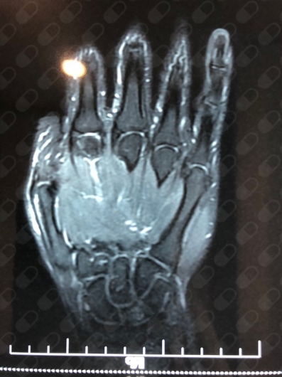 Norma Izchel Orozco Aponte-10