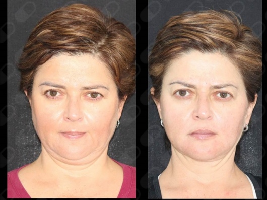 María Fernanda Medrano Madrazo-11