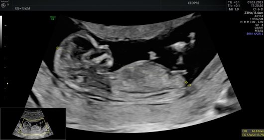 Mario Isaac Lumbreras Márquez-4